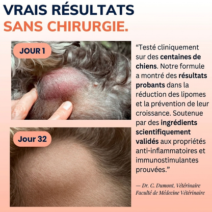 Champivital™ | Complément contre les Lipomes
